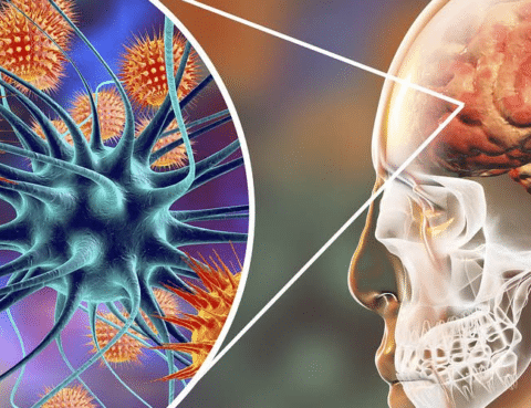 Tipos de daño cerebral: la meningitis