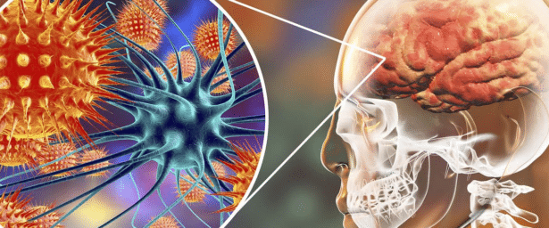 Tipos de daño cerebral: la meningitis